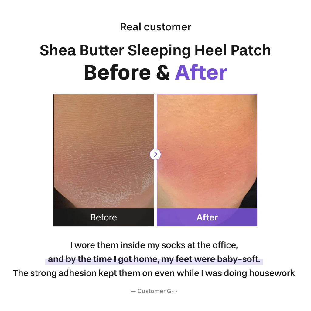 Baren - Shea Butter Sleeping Heel Patch