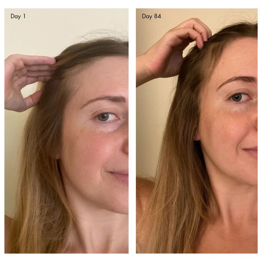 Agent Nateur holi (growth) 84 advanced leave-in scalp treatment