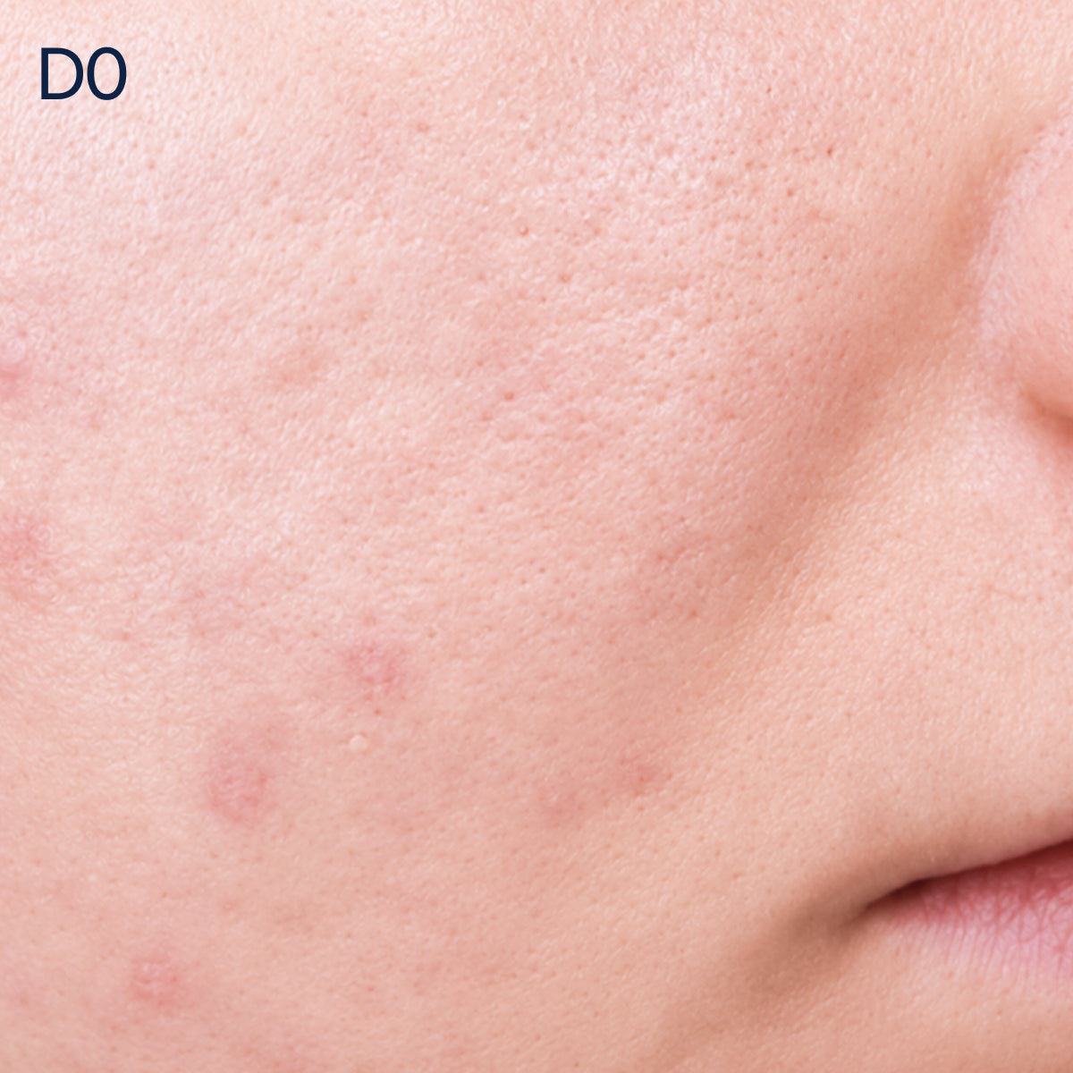 Biologique Recherche - Serum Vivant