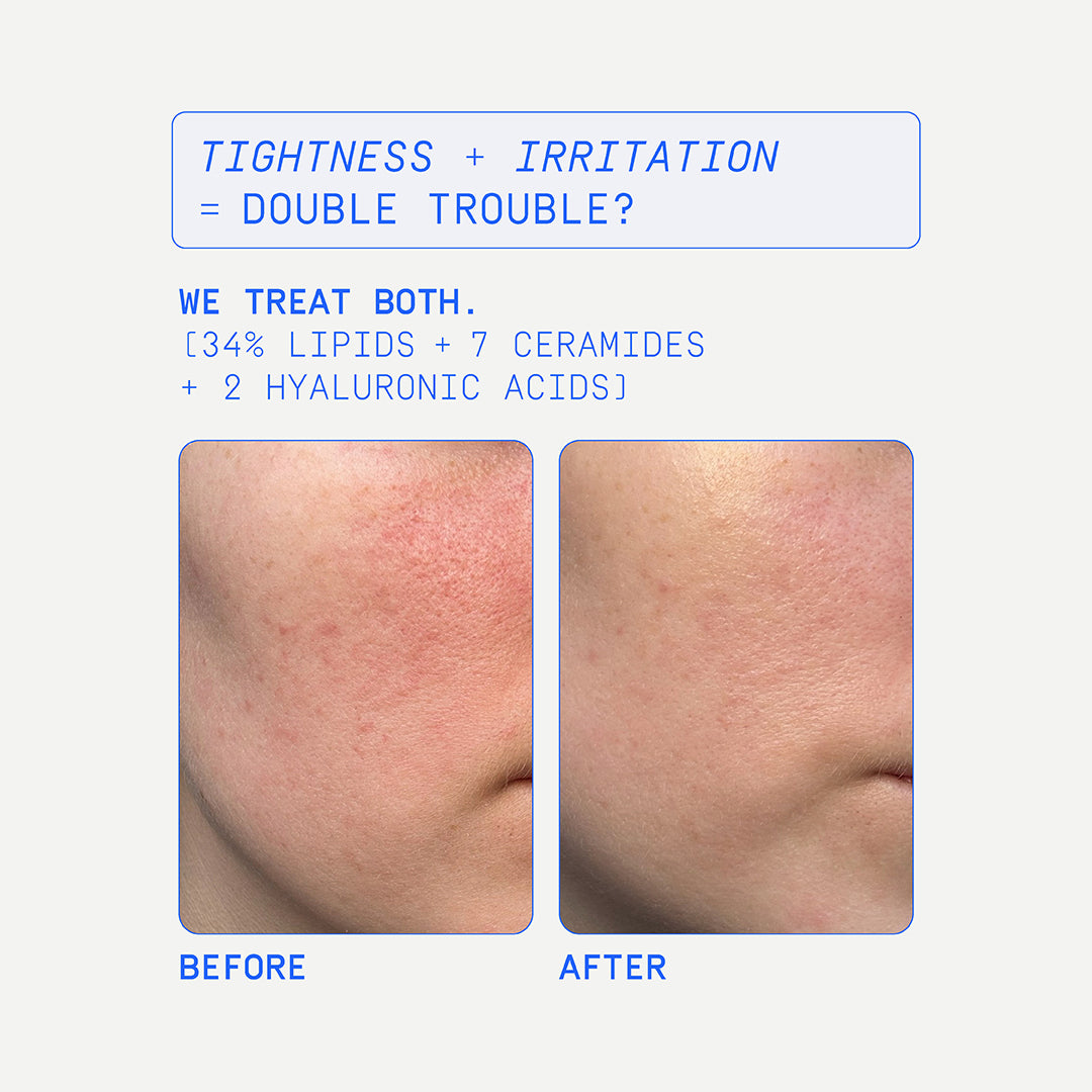 Mimetique - Skin Restore+ Face Cream