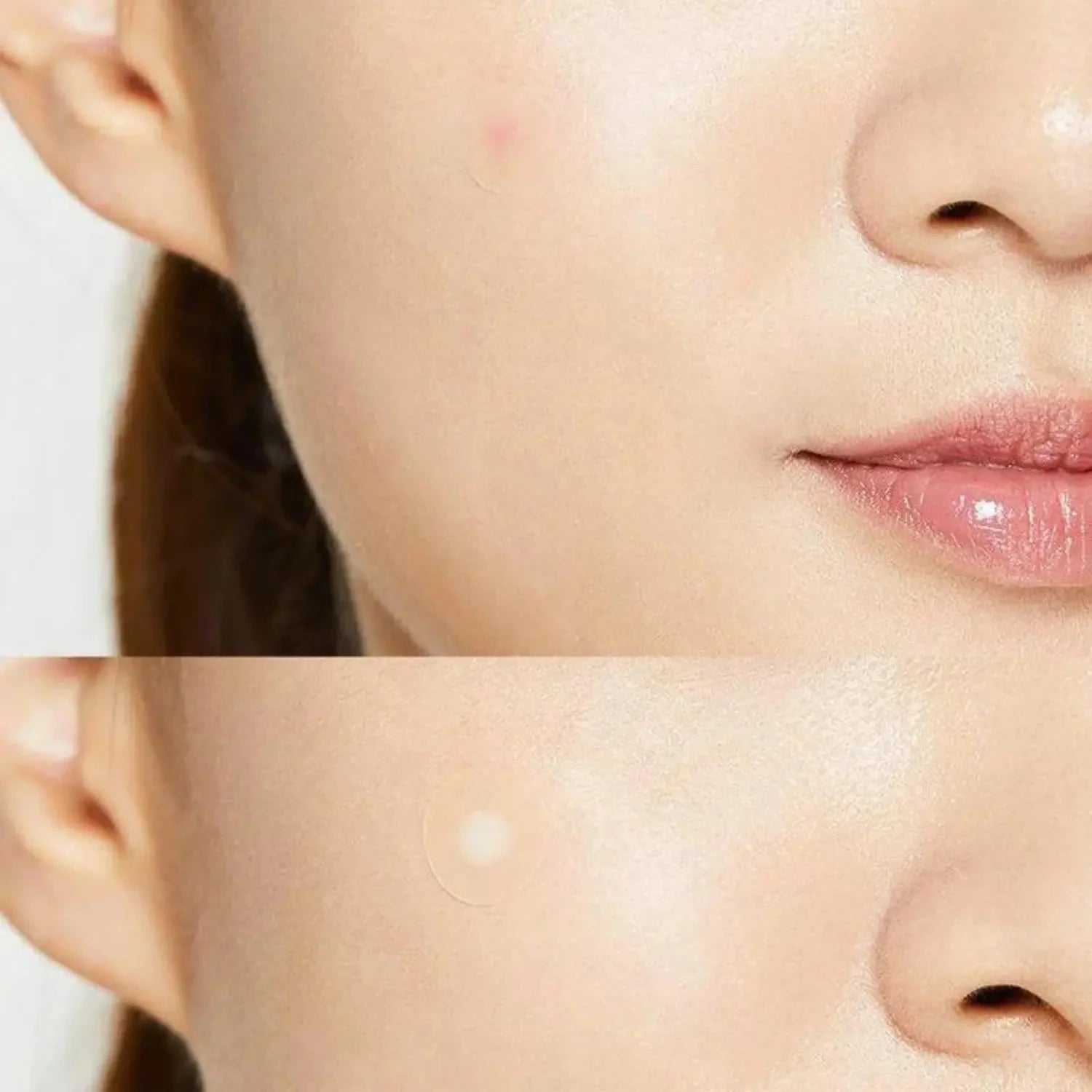 COSRX - Acne Pimple Master Patch