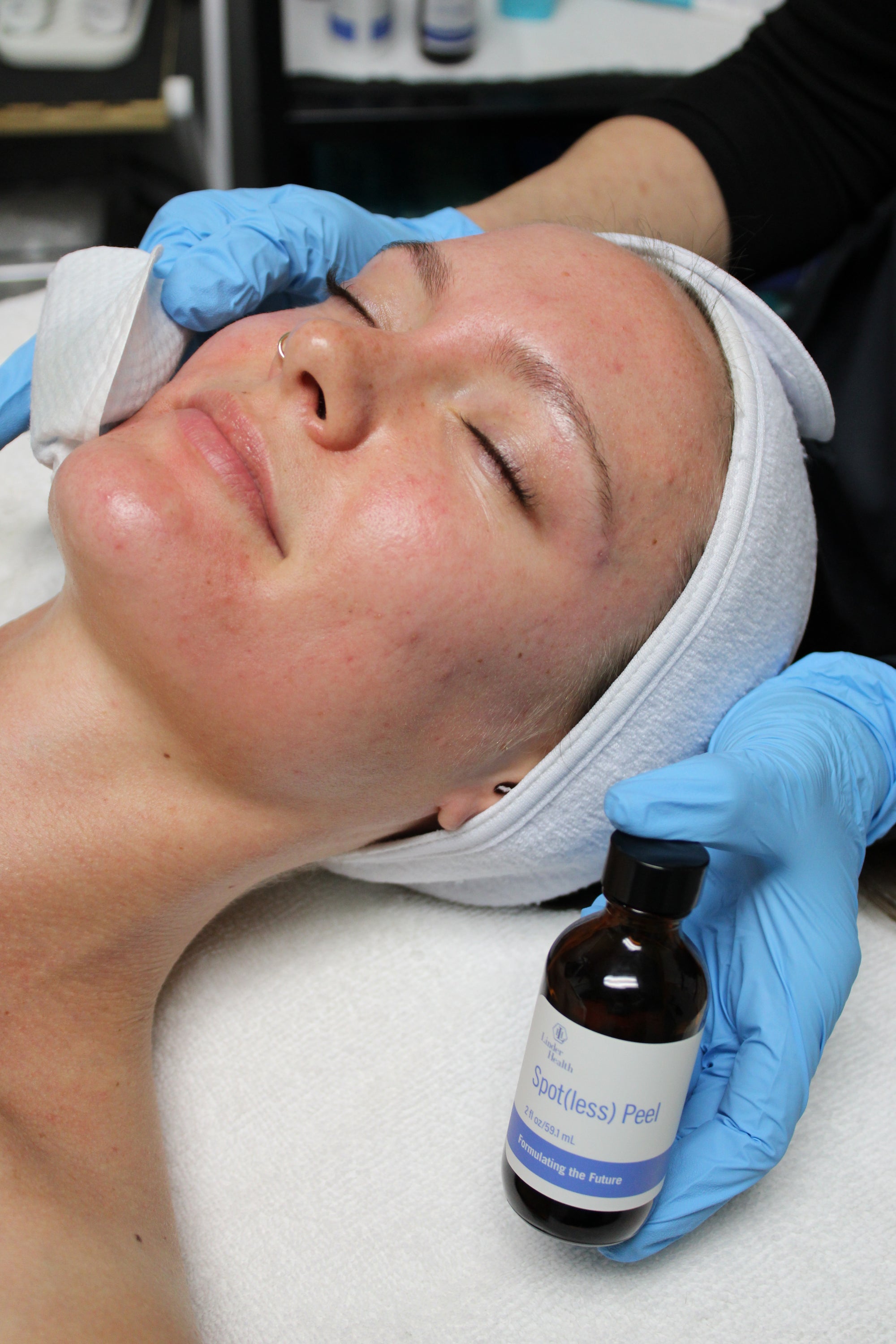 [Spot]less Peel by Linder Health - Living Beauty