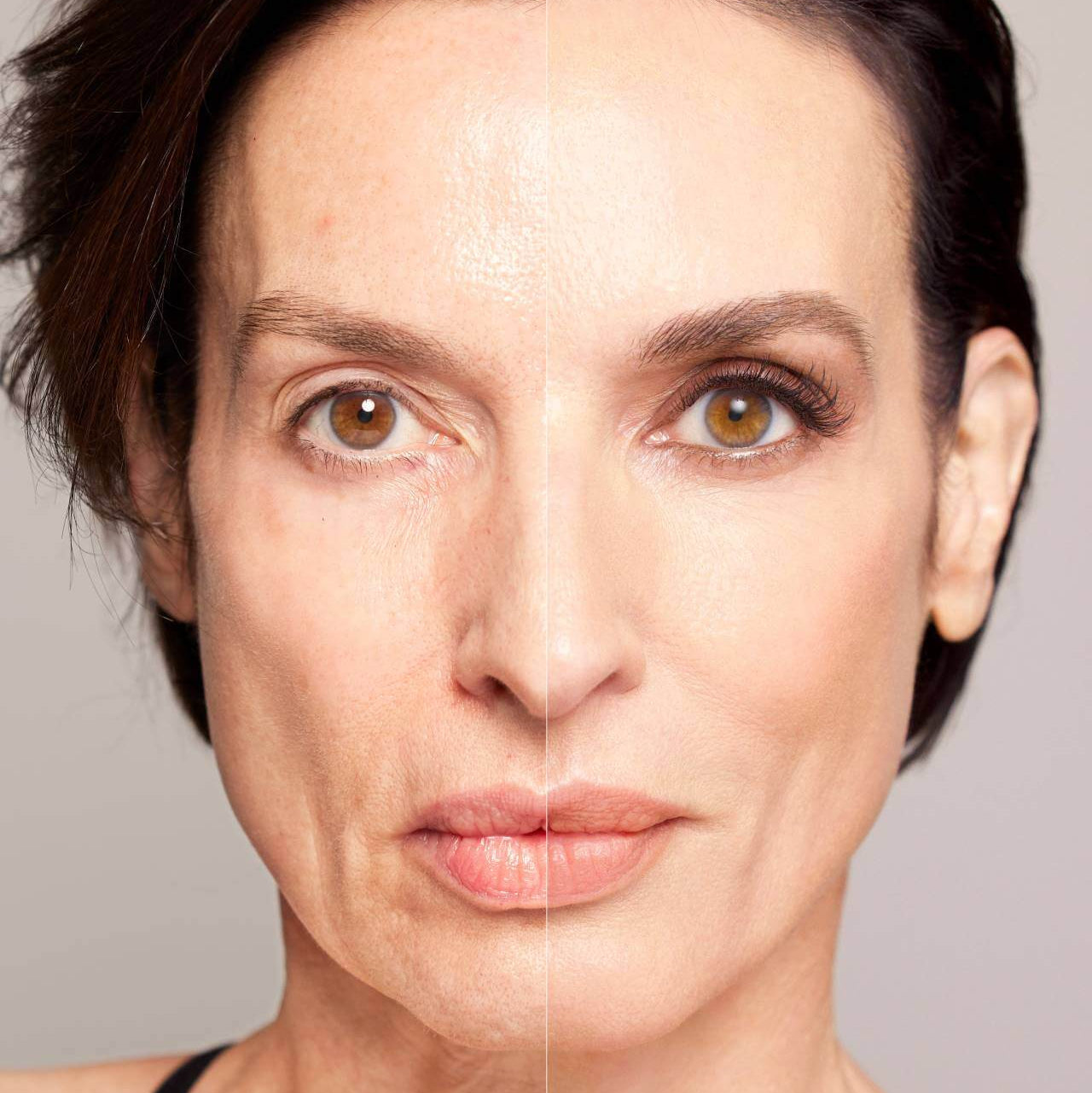 IRIS - Living Beauty