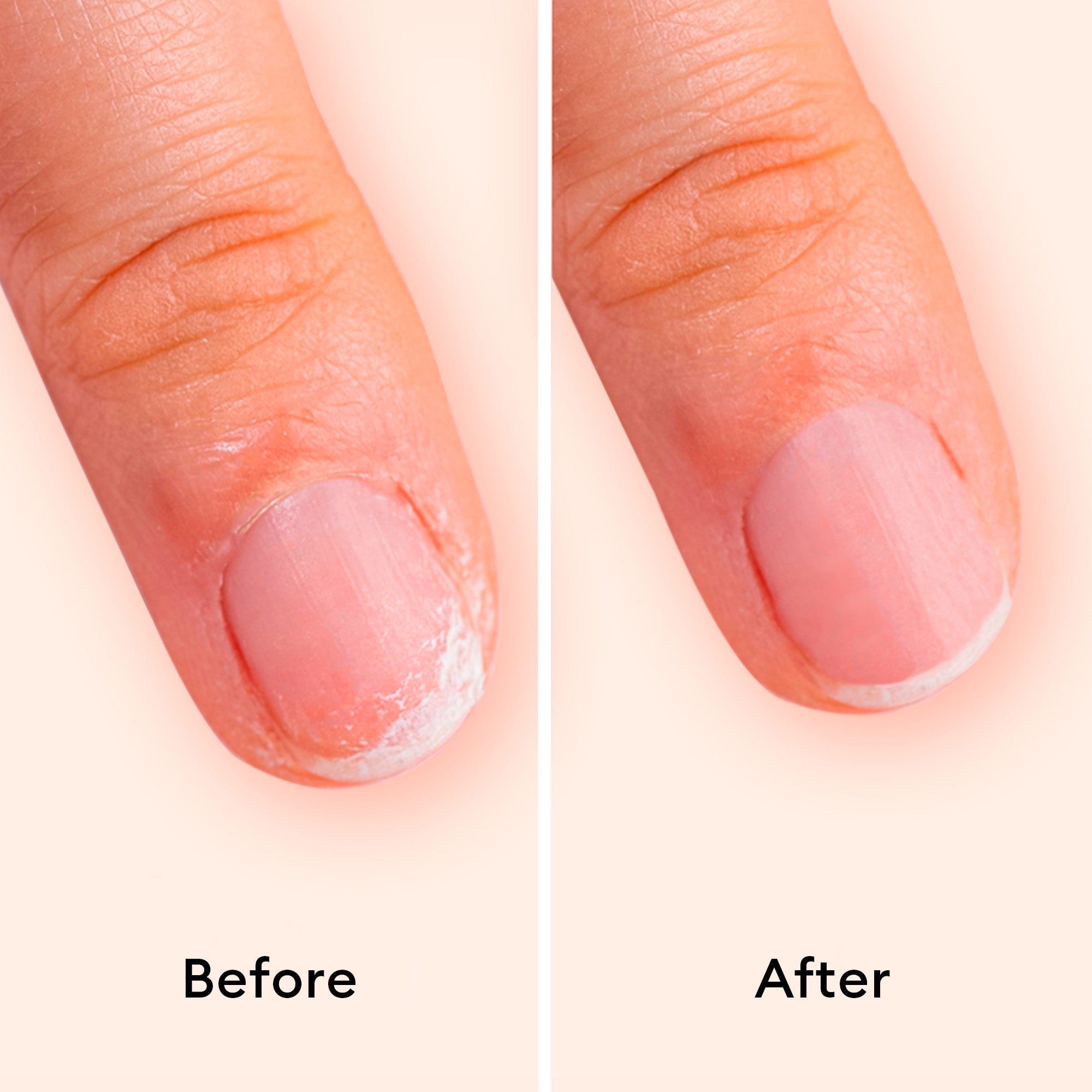 Keratin Booster - Living Beauty