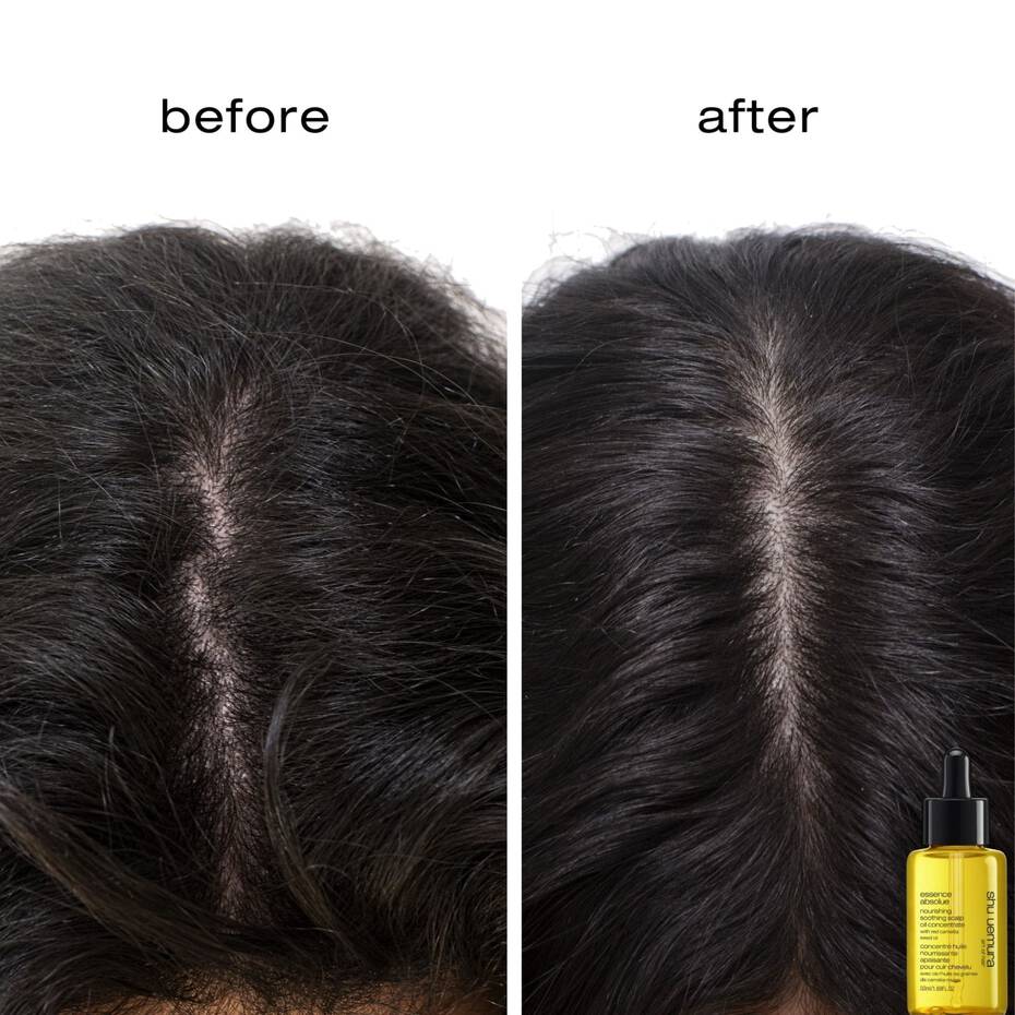 Essence Absolue Pre-Shampoo & Nourishing Treatment Scalp Oil - Living Beauty